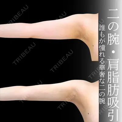 アリエル美容クリニック 横浜院 加藤 敏次医師の症例