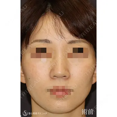 聖心美容クリニック 銀座院 牧野 陽二郎医師の症例