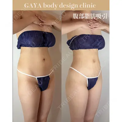 GAYA body design clinic 飯ヶ谷 重来医師の症例