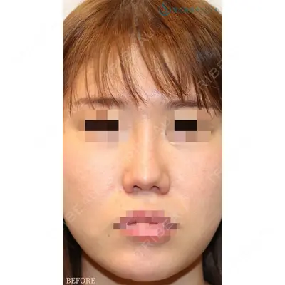聖心美容クリニック 銀座院 牧野 陽二郎医師の症例