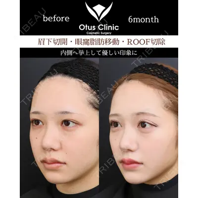 Otus Clinic 【オータスクリニック】 中 徳太郎医師の症例