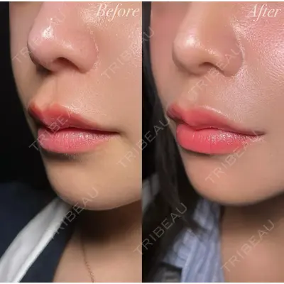 R Beauty CLINIC 銀座院 吉田　慧医師の症例