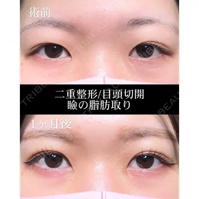 HAAB×DREAM BEAUTY CLINIC 大阪梅田院 鈴木 馨斗医師の症例