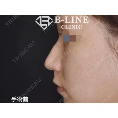 B-LINE CLINIC 池袋院 小池 康弘医師の症例