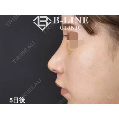 B-LINE CLINIC 池袋院 小池 康弘医師の症例