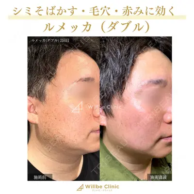 ウィルビークリニック 立川院の症例
