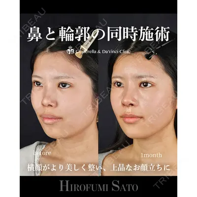 シンデレラ＆ダヴィンチクリニック 佐藤 博文医師の症例