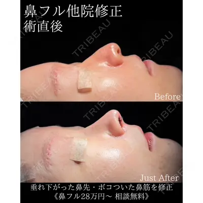 Zetith Beauty Clinic 大阪心斎橋院 楠本 拓哉医師の症例