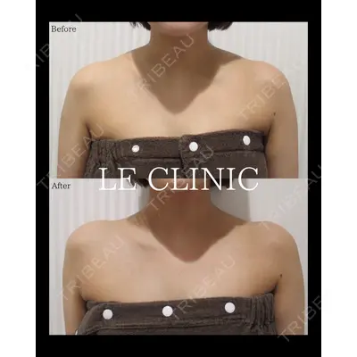 LE CLINICの症例