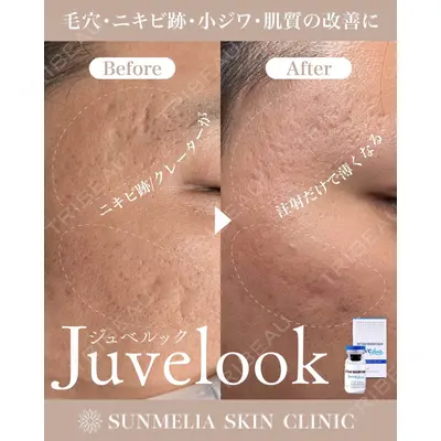 SUNMELIA SKIN CLINICの症例