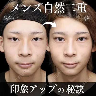 MEMOTO CLINIC 名古屋 鈴木 大路医師の症例