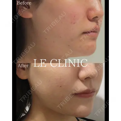 LE CLINICの症例
