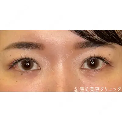 聖心美容クリニック 福岡院 權藤 理絵医師の症例