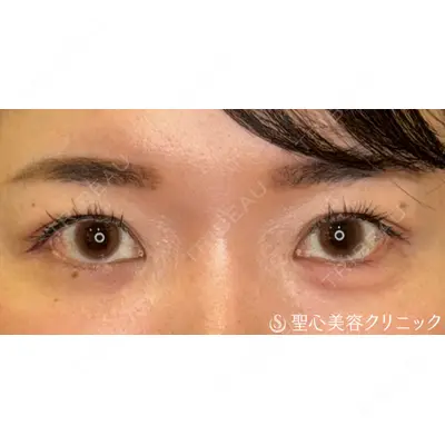 聖心美容クリニック 福岡院 權藤 理絵医師の症例