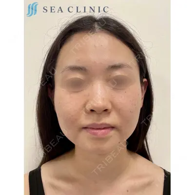 SEA CLINIC（シークリニック） 沼澤 茂医師の症例
