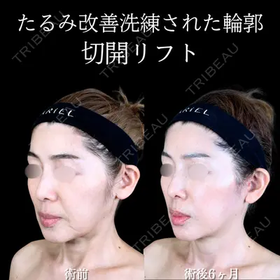 アリエル美容クリニック 大宮院 阪野 一世医師の症例