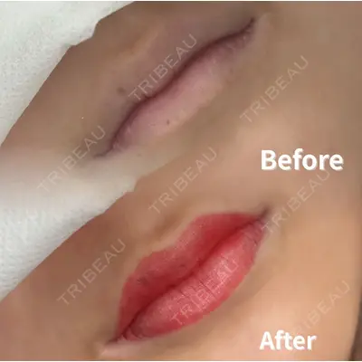 Belle Via Clinic 森田 佑望医師の症例