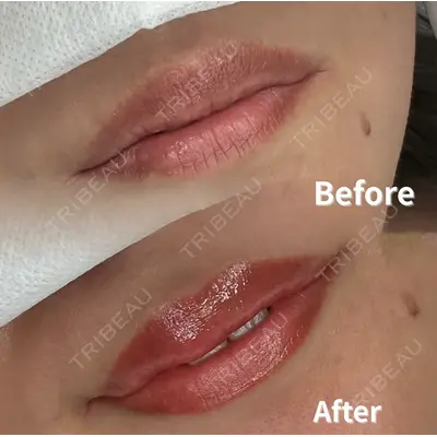 Belle Via Clinic 森田 佑望医師の症例
