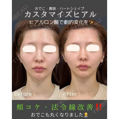 ルラ美容クリニック 仙台院 / ルラスキンクリニック 仙台院 橋本 英樹医師の症例