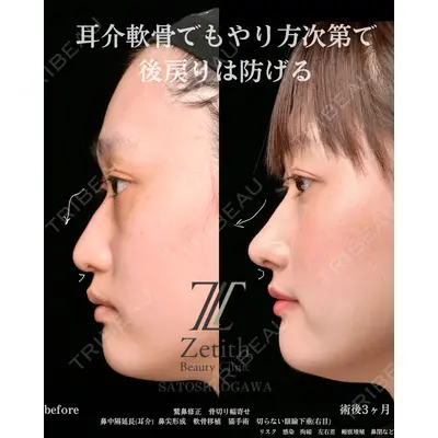 Zetith Beauty Clinic 銀座院 小川 悟史医師の症例