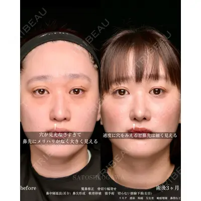 Zetith Beauty Clinic 銀座院 小川 悟史医師の症例