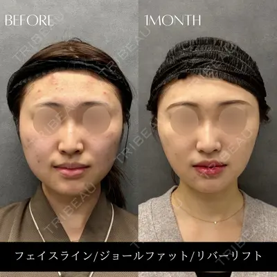 RIVER CLINIC（リバークリニック）大阪院 木家 佑理子医師の症例