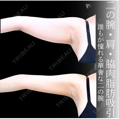 アリエル美容クリニック 横浜院 加藤 敏次医師の症例