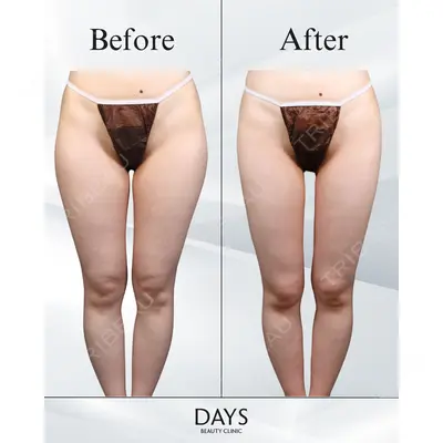 Days Beauty Clinic 本厚木院の症例