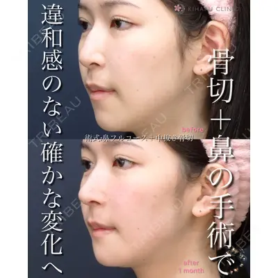 KIHARU CLINIC 沖野 尚秀医師の症例