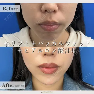 MIL CLINIC OSAKA 岩脇 槙佑医師の症例