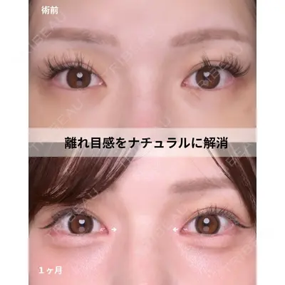Zetith Beauty Clinic 福岡院 羽根 和秀医師の症例