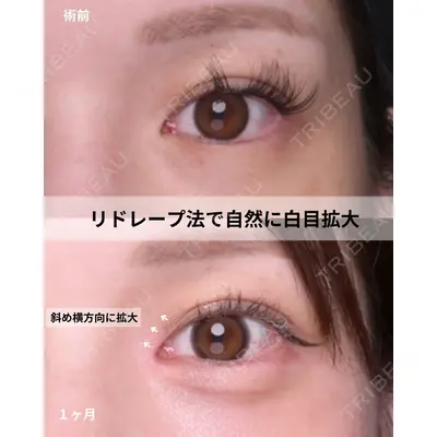Zetith Beauty Clinic 福岡院 羽根 和秀医師の症例