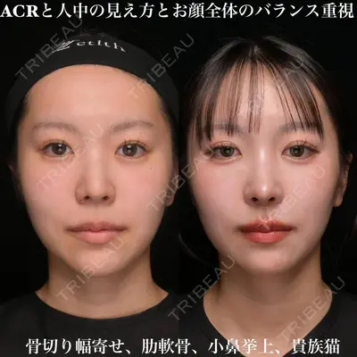 Zetith Beauty Clinic 銀座院 鉄 鑠医師の症例