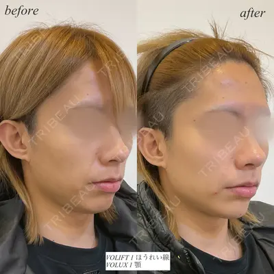 DMTC CLINIC 日本橋院 山中大介医師の症例