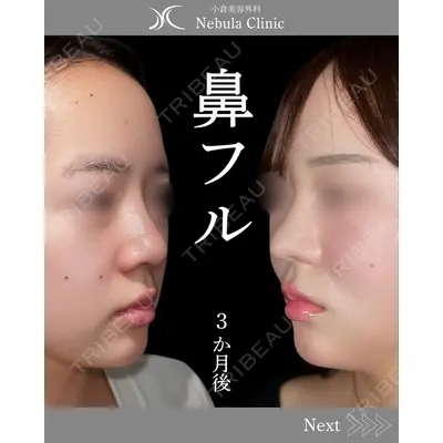 小倉美容外科ネビュラクリニック 浦野 正樹医師の症例
