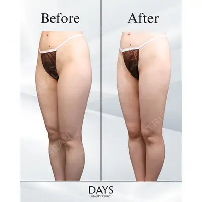 Days Beauty Clinic 本厚木院の症例
