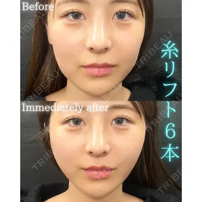 THE FIRST CLINIC 町田院の症例