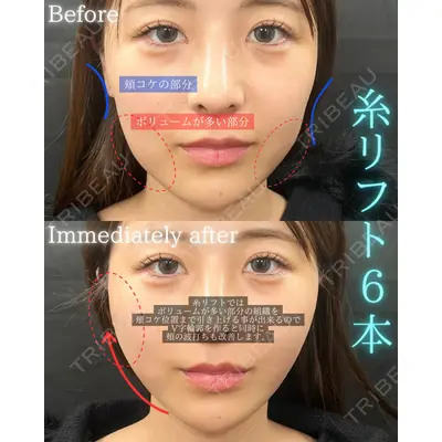 THE FIRST CLINIC 町田院の症例