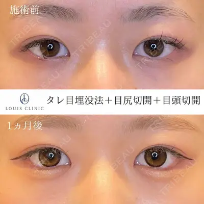 LOUIS CLINIC 二子玉川院【ルイクリニック】 小松 塁医師の症例