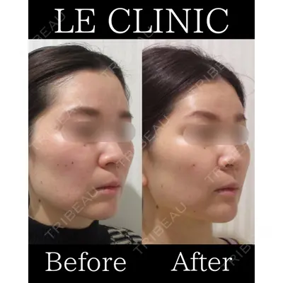 LE CLINICの症例