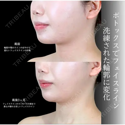 アリエル美容クリニック 横浜院 渡邉 光医師の症例