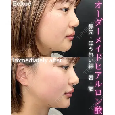 THE FIRST CLINIC 町田院の症例
