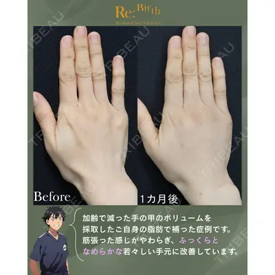Re:Birth Clinic Nagoya 河之口 大輔医師の症例