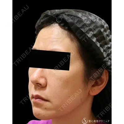 聖心美容クリニック 熱海院 小林 美幸（皮膚科）医師の症例