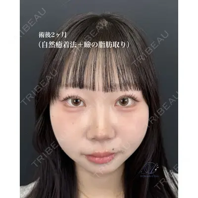 AI Beauty Clinic （エーアイ美容クリニック） 尾崎 宥文医師の症例