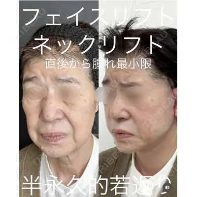 ルラ美容クリニック 渋谷本院 武内 大医師の症例