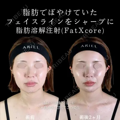 アリエル美容クリニック 郡山院 安齋 誠基医師の症例