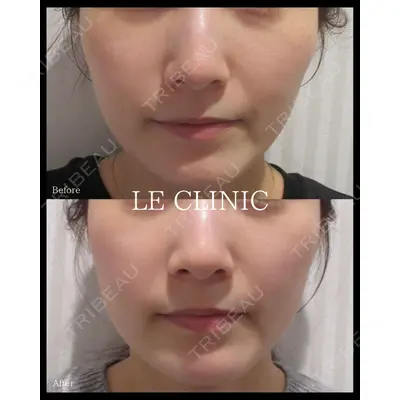 LE CLINICの症例