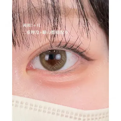 AI Beauty Clinic （エーアイ美容クリニック） 尾崎 宥文医師の症例