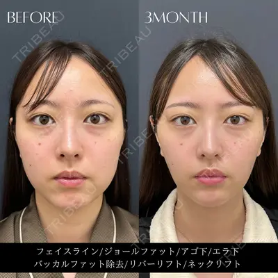 RIVER CLINIC（リバークリニック）の症例